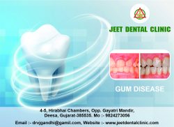 Gum disease is best service in Deesa.