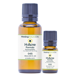 H-Acne Formula – Natural Acne Treatment for your Acne Symptoms