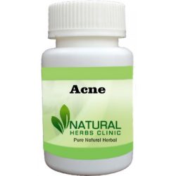 Herbal Product for Acne