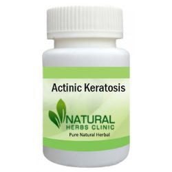 Herbal Product for Actinic Keratosis
