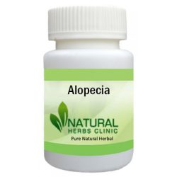 Herbal Product for Alopecia