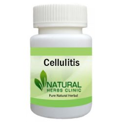 Herbal Product for Cellulitis