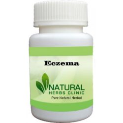 Herbal Product for Eczema
