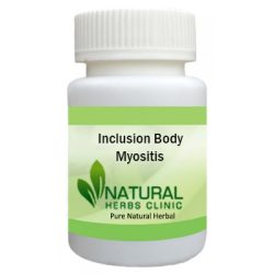 Herbal Product for Inclusion Body Myositis