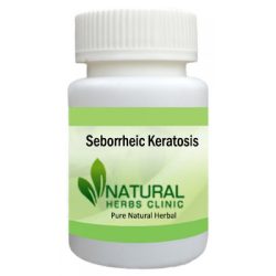 Herbal Product for Seborrheic Keratosis