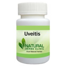 Herbal Product for Uveitis