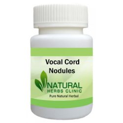 Herbal Product for Vocal Cord Nodules