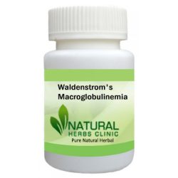 Herbal Product for Waldenstrom’s Macroglobulinemia