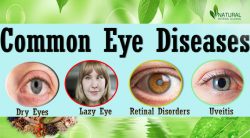 Causes and Symptoms of Eye Diseases
