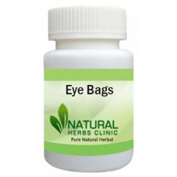Herbal Supplements for Eye Bags