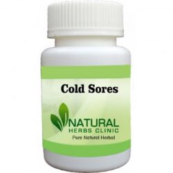 Herbal Supplements for Cold Sores