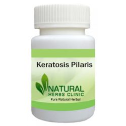 Herbal Supplements for Keratosis Pilaris