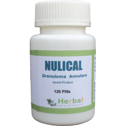 Herbal Treatment for Granuloma Annulare | Remedies | Herbal Care Products