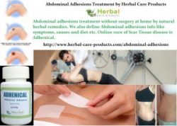 11 Natural Home Remedies for Abdominal Adhesions