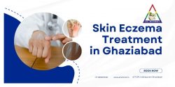 Skin Eczema Treatment in Ghaziabad – AL – Rehmat