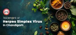 Treatment of Herpes Simplex Virus in Chandigarh