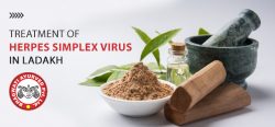 Treatment of Herpes Simplex Virus in Ladakh