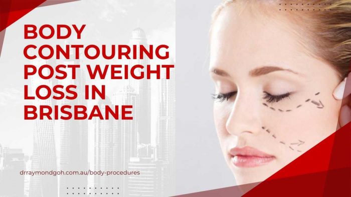 Body contouring post weight loss in Brisbane