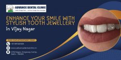 Enhance Your Smile with Stylish Tooth Jewellery in Vijay Nagar