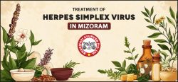 Treatment of Herpes Simplex Virus in Mizoram