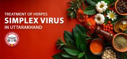 Treatment of Herpes Simplex Virus in Uttarakhand