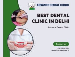 Best Dental Clinic in Delhi for Your Smile