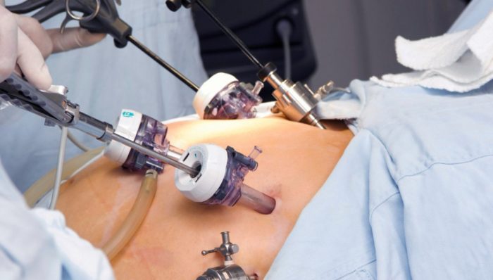 Top Bariatric Surgery in Antalya: Gastric Turkey’s Expert Ca