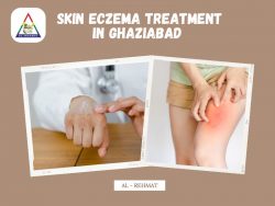 Skin Eczema Treatment in Ghaziabad – AL – Rehmat