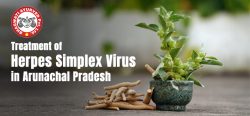 Treatment of Herpes Simplex Virus in Arunachal Pradesh