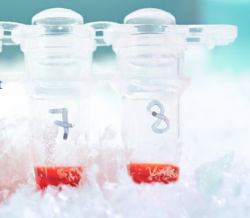 Complement component C3a
