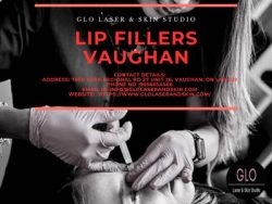 Achieve Enhanced Beauty With Lip Fillers Vaughan Experts