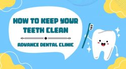 How to Keep Your Teeth Clean – Advance Dental Clinic