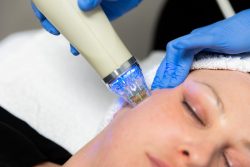 Experience Radiant Skin with Ink Illusions’ Advanced RF Microneedling Treatment London
