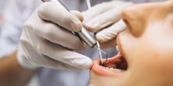 Trusted Pediatric Dentist in Noida for Your Child’s Healthy Smile – Hope Dental and Esthetic Clinic