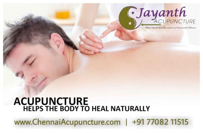 Acupuncture Treatment in Chennai | Best Acupuncturist in Anna Nagar and Chetpet