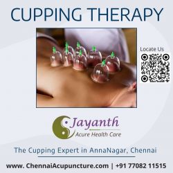 Cupping Therapy in Anna Nagar, Chennai