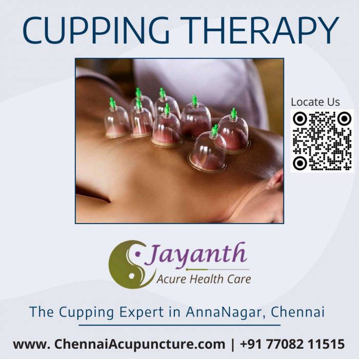 Cupping Therapy in Anna Nagar, Chennai