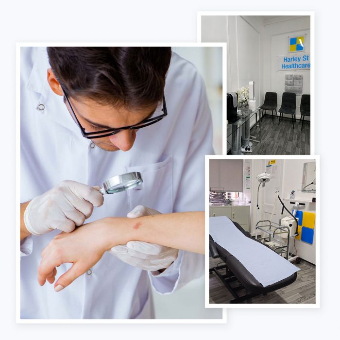 Dermatology Clinic London – Expert Skin Care
