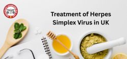 Treatment of Herpes Simplex Virus in UK – Bhagwati Ayurved