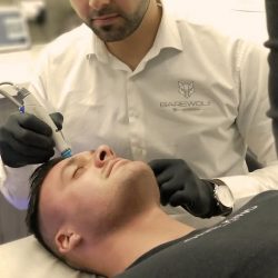Expert Men Facial Treatments in Glebe