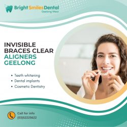 Invisible Braces Clear Aligners Geelong
