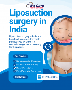 Liposuction Surgery in India