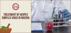 Treatment of Herpes Simplex Virus in Nigeria – Bhagwati Ayurved