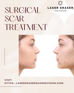 Advanced Surgical Scar Treatment For Better Healing