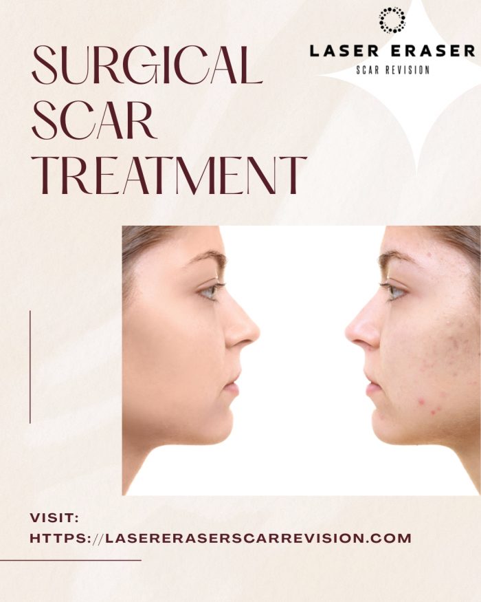 Advanced Surgical Scar Treatment For Better Healing
