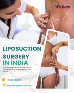 Liposuction Surgery in India