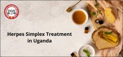Herpes Simplex Treatment in Uganda – Bhagwati Ayurved