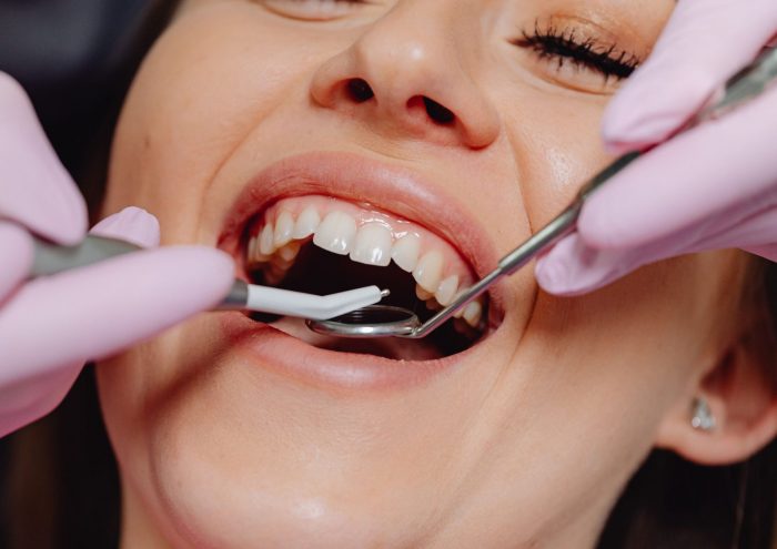 Emergency Dentist Turramurra – Fast & Reliable Emergency Dental Care | Atria Dental Gordon
