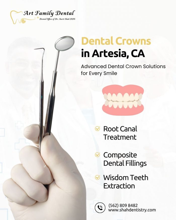 Dental Crowns in Artesia, CA – Art Family Dental