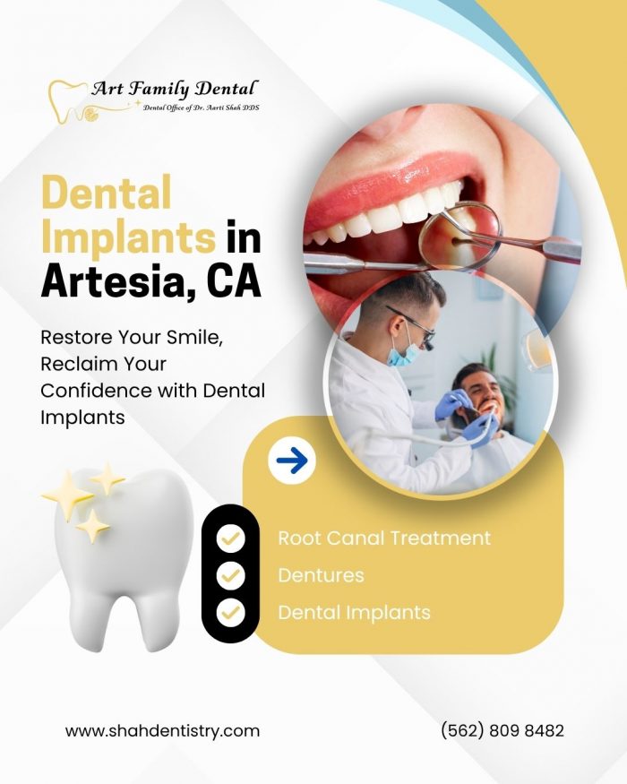 Dental Implants in Artesia, CA – Art Family Dental